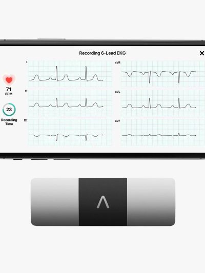 AliveCor KardiaMobile 6L Personal EKG Monitor, Black - KM-6L-E